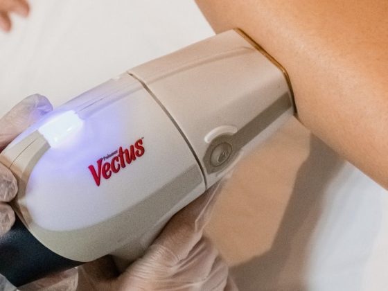 Clínica de estética presenteia clientes com 4 sessões de depilação a laser